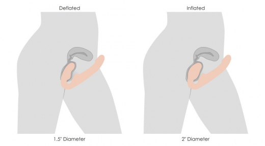 Strap-On Vibrator riemenlos aufblasbar m. Fernsteuerung Twist beige