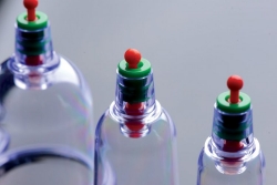 Vakuum Schröpf-Set 6-teilig Sukshen