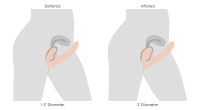 Vibromasseur Strap-On sans ceinture gonflable avec télécommande Evoke peau